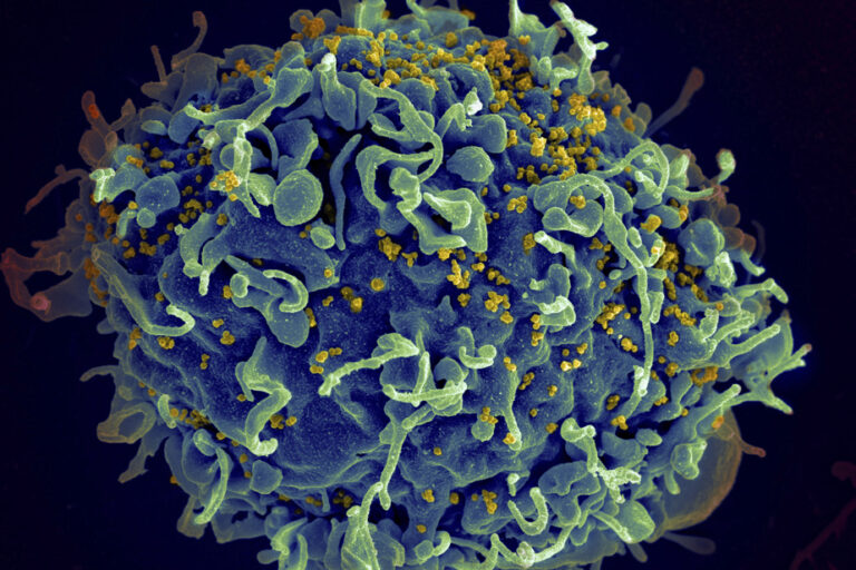 HIV-Positive Patients in Remission, ‘Living Proof’ of Possible Victory Against HIV