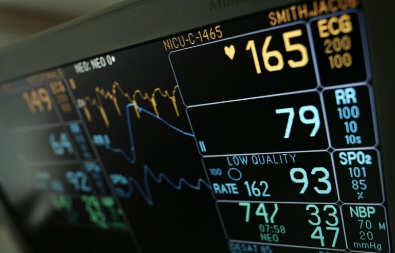 AI could detect atrial fibrillation