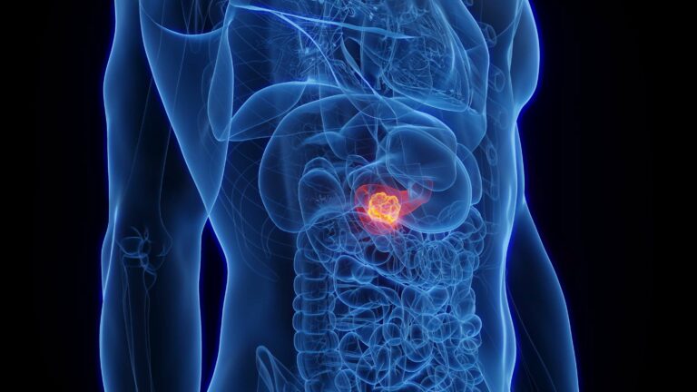 Understanding Stomach Cancer: Key Early Warning Signs for All Ages