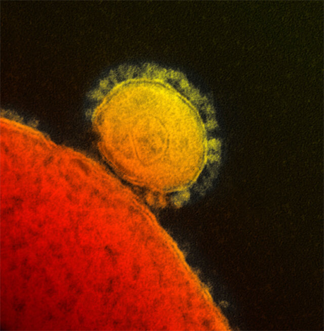 Avant 2023, il avait fallu un événement mondial majeur comme la pandémie de coronavirus pour constater de telles augmentations dans l’utilisation des mots.