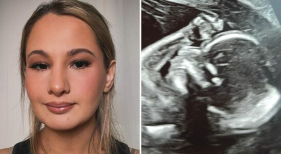 Gypsy-Rose Blanchard ultrasound