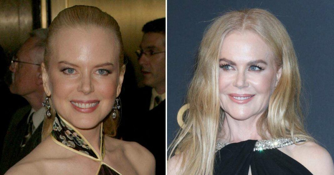 Les admirateurs de Nicole Kidman lui conseillent d'arrêter le Botox après une vidéo qui relance les spéculations sur la chirurgie esthétique : 'C'est effrayant'