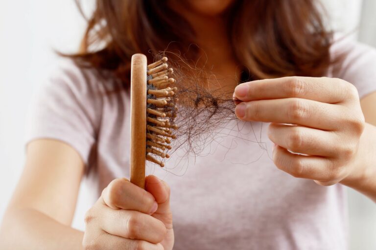 Cinq impacts de l'hiver sur vos cheveux : des pellicules à la perte de volume, et nos conseils pour des cheveux plus longs et en meilleure santé avant Noël.