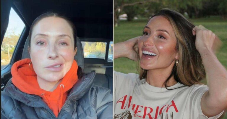 Bristol Palin, 34 ans, révèle sa paralysie faciale liée au stress : des images saisissantes à découvrir