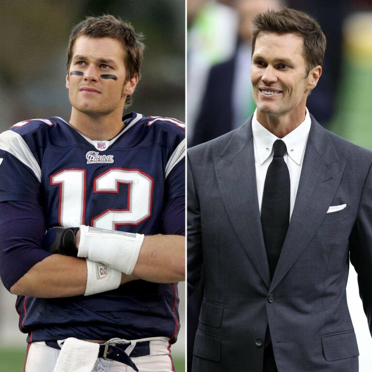 Tom Brady a-t-il eu recours à la chirurgie esthétique ? Les rumeurs surgissent après son annonce pour le Super Bowl 2025.